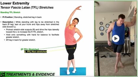 Tensor Fascia Latae (TFL) | Clinical Anatomy & Stretches