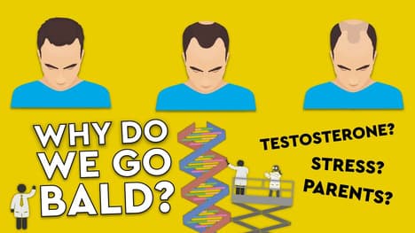 Why Do We Go Bald?