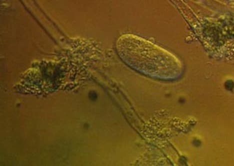 Anaerobic Respiration: Observing Yeast's Oxygen-Free Energy Production