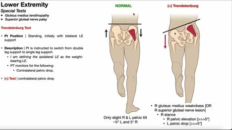 Trendelenburg Test | Rationale & Interpretation