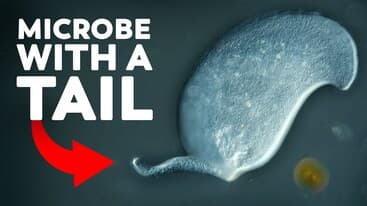 This Microbe Hasn't Been Seen Since The 1930s