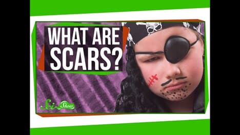 What are Scars?