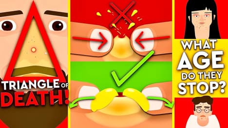 Everything you're doing Wrong with Pimples #ACNE #MYTHS