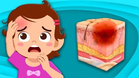 Discover How Bruises Happen! | Human Body Songs For Kids.