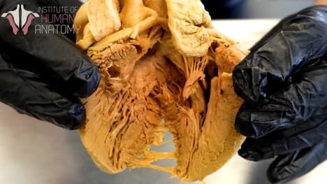 How the Heart Contracts: Understanding the Electrical Activity and Heart Arrhythmias