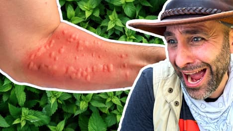 STUNG by a Costa Rican Bush!