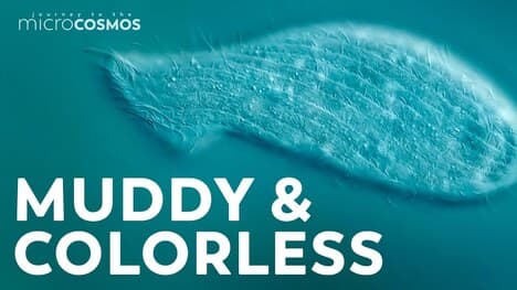 The Spatula-Shaped Ciliate Family