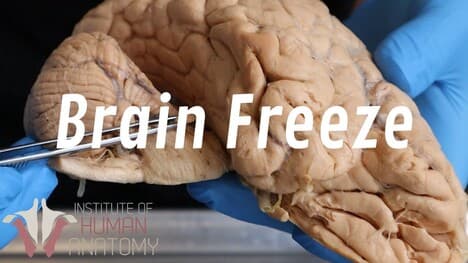 What Is a Brain Freeze??
