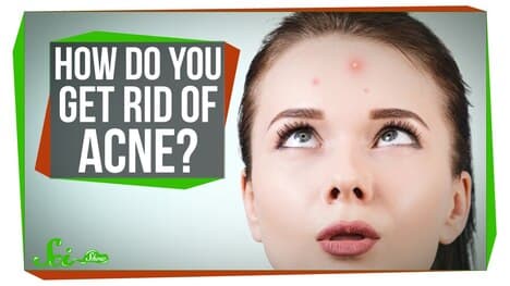 How Do You Get Rid of Acne?
