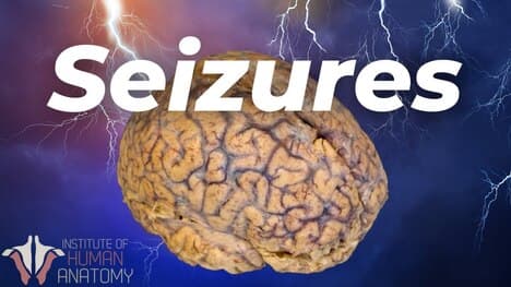Understanding Seizures: Types, Causes, and Management