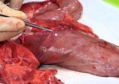 Dissection: Lungs