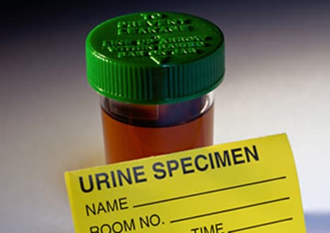 Discovery of Phosphorus