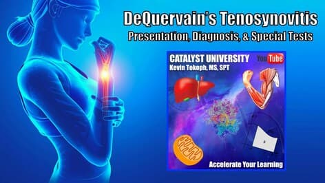 DeQuervain's Tenosynovitis | Snuffbox Anatomy, Diagnosis, & Special Tests