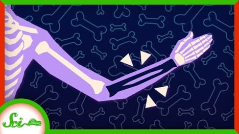 You're Losing Bones Right Now