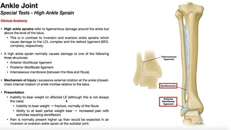 High Ankle Sprains | Anatomy, Presentation, Diagnosis, & Treatment Basics