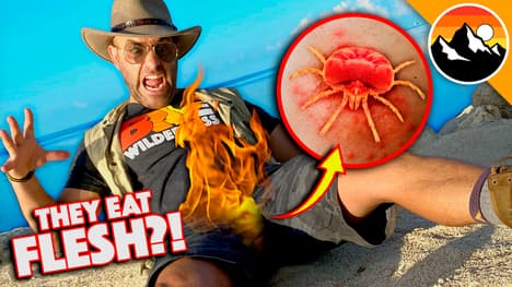 Bitten by Chiggers! Great Balls of FIRE!