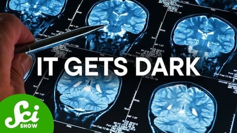 Einstein Didn't Want People To Study His Brain