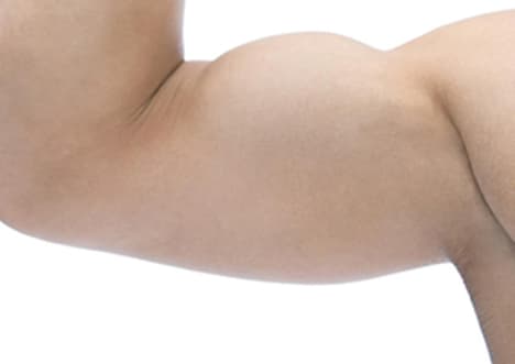 Acquired characteristics