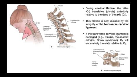 The Transverse Cervical Ligament EXPLAINED