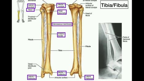 Anatomy | Specific Parts of the Tibia & Fibula [+ Left vs. Right]
