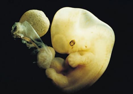 Embryo