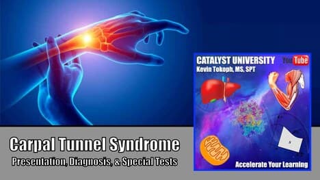 Carpal Tunnel Syndrome | Presentation, Diagnosis, & Special Tests