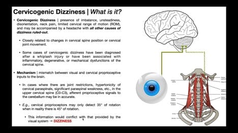 Cervicogenic Dizziness | What is it? Mechanism & Diagnosis