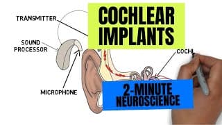 Two Minute Neuroscience Cochlear Implants
