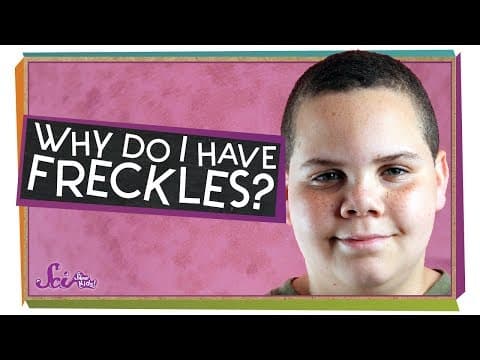 Why Do I Have Freckles?