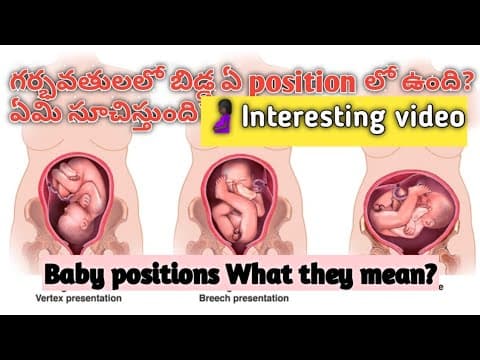 Baby position during pregnancy and what they mean/Normal delivery position in telugu