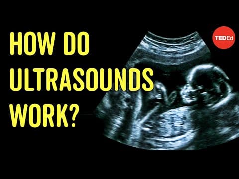 How to see with sound - Jacques S. Abramowicz - YouTube