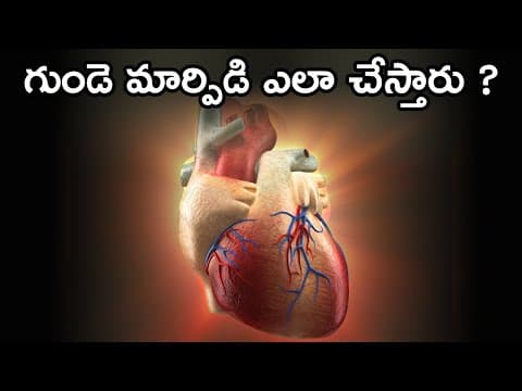 How heart Transplant Works
