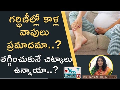 గర్భిణీల్లో కాళ్ల వాపులు ప్రమాదమా.? || Leg Swelling During Pregnancy || Edema || Dr Jayanthi