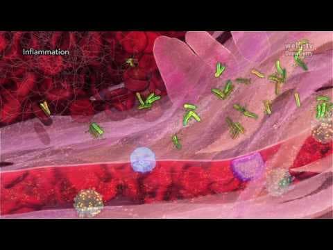 Inflammation (2014) Drew Berry wehi.tv