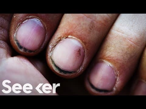 You’re Too Clean, and It’s Messing With Your Immune System