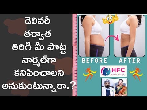 డెలివరీ తర్వాత మీ పొట్ట మళ్లీ నార్మల్‌ అవ్వాలంటే..!
