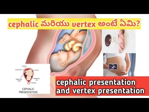 cephalic and vertex presentation during pregnancy/in telugu