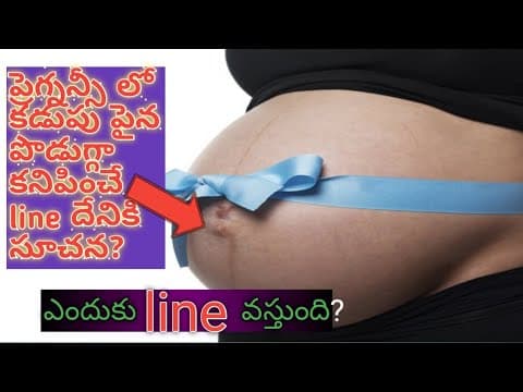 causes for Linea Nigra in pregnancy Telugu లో/ప్రెగ్నన్సీ లో పొడవు లైన్ సూచన ఏమిటి?