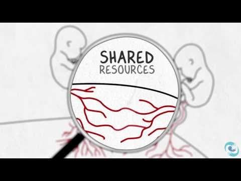 Monochorionic vs Dichorionic Twin Pregnancy