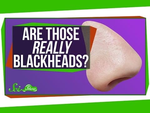 Are Those Really Blackheads