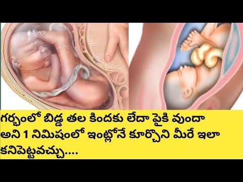 కడుపులో బిడ్డ తల కిందుకు లేదా పైకి ఉందా అని మీరే 1 సెకండలో కనిపెట్టవచ్చు/pregnancy tips in telugu