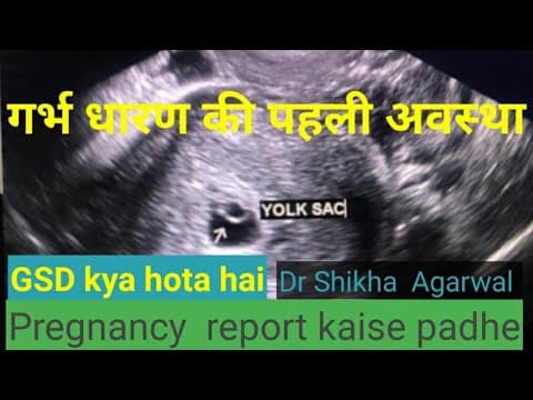 Gestational sac gs/how to read pregnancy report /yolk sac/ doctor home