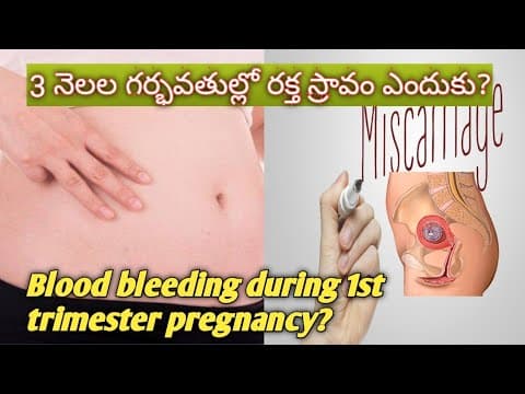 1st trimester bleeding problems in telugu/మూడు నెలల గర్భవతుల్లో రక్త స్రావం ఎందుకు?