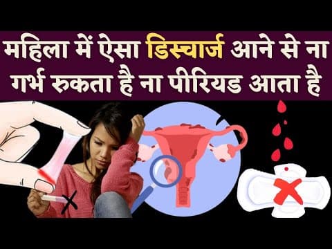 ऐसा डिस्चार्ज होना प्रेगनेंसी का सबसे पक्का लक्षण है-white discharge in women-pregnancy symptoms