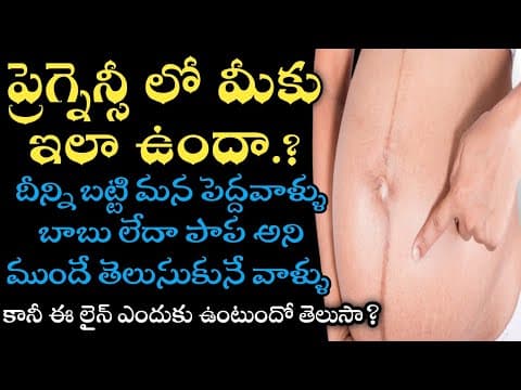 linea nigra during pregnancy boy or girl