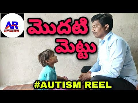 Speech Therapy | Oro Motor Exercises to Develop Speech | Tongue exercises for clear speech | at home