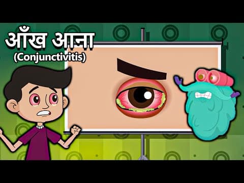 आँख आना - कंजंक्टिवाइटिस - What Causes Conjunctivitis