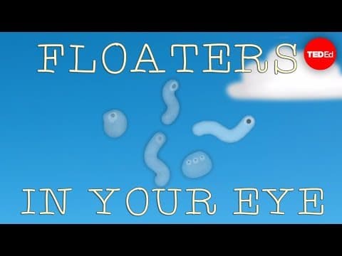 What are those floaty things in your eye?-michael mauser