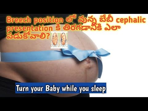 ఇలా పడుకోండి కడుపులో బిడ్డ cephalic position కి turn అవుతుంది/how to turn breech baby to cephalic