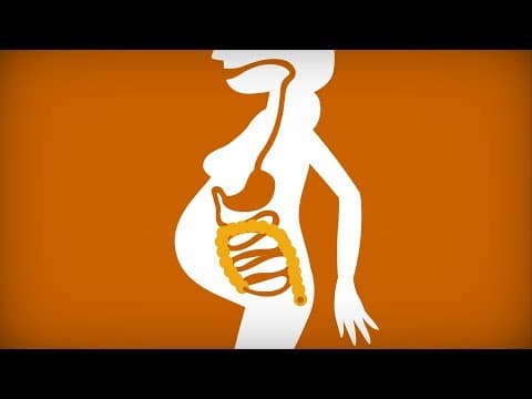 Constipation during pregnancy